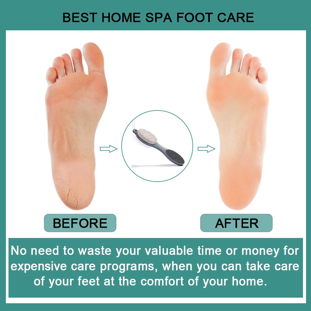 CAREHOOD Foot File Callus Remover - Multi Purpose 4 in 1 Feet Pedicure Tools with Foot Scrubber, Pumice Stone, Foot Rasp and Sand Paper for Home Foot Care (Grey Pedicure Foot File) : Beauty