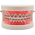 Standard Tooth Teaching Mallocclusion Orthodontic Teeth Model with Brackets Archwire Buccal Tube Tool