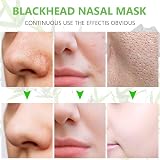 ACWOO Nose Strips 60Pcs Pore Strips Blackheads Deep Cleansing Removes Dirt view 4