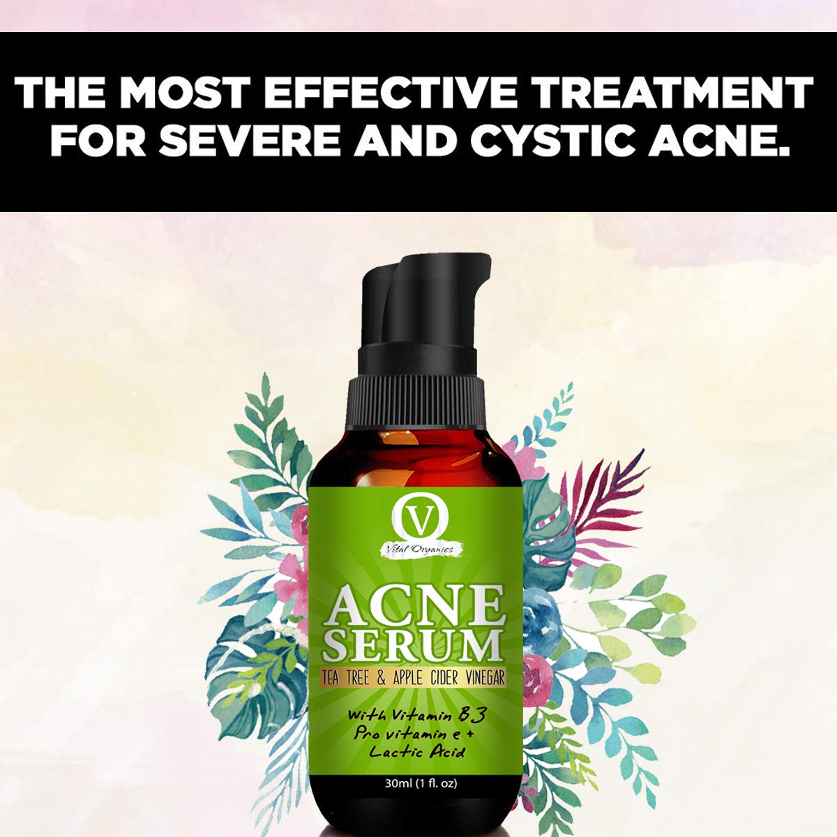 rory anti acne serum