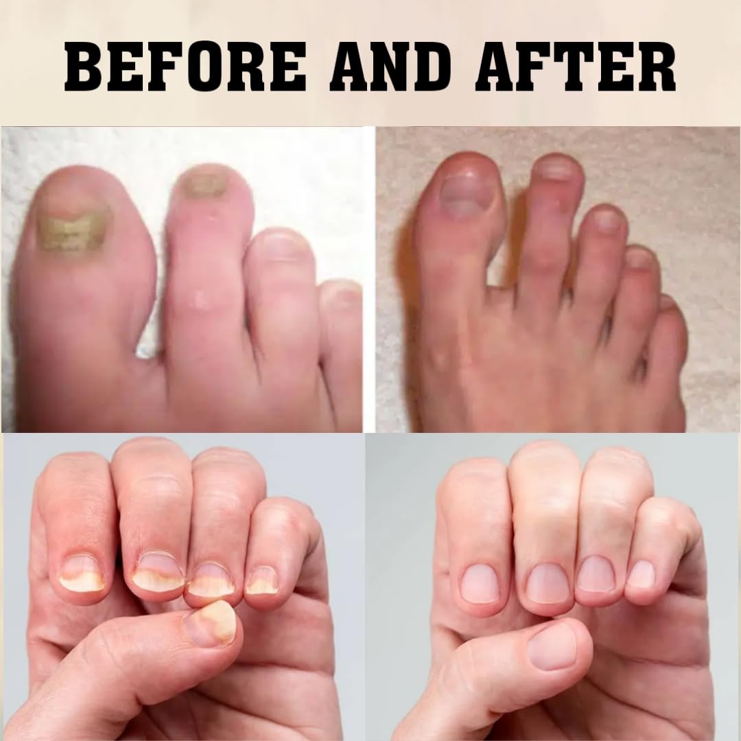 Princess Essential Oil Nail Fungus Treatment /100% Made in USA/Organic Natural Ingredients/Healthy Renewal/Restore Weak & Discolored/Moisturize Cuticles 1/2 FL.OZ 14 ML - Image 5