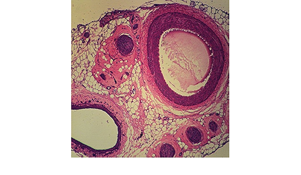 Mammal Artery Vein And Nerve C S 7 M Hematoxylin And Eosin Microscope Slide Amazon Com Industrial Scientific