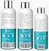 Oily Skin Control and Adult Acne Regimen. 3-Step System Includes Cleanser, Mattifying Moisturizer and Toner with Tea Tree & Salicylic Acid. Sample Set. Best Hormonal Acne Treatment.