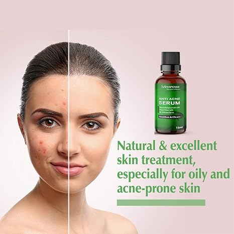 lyakin anti acne serum