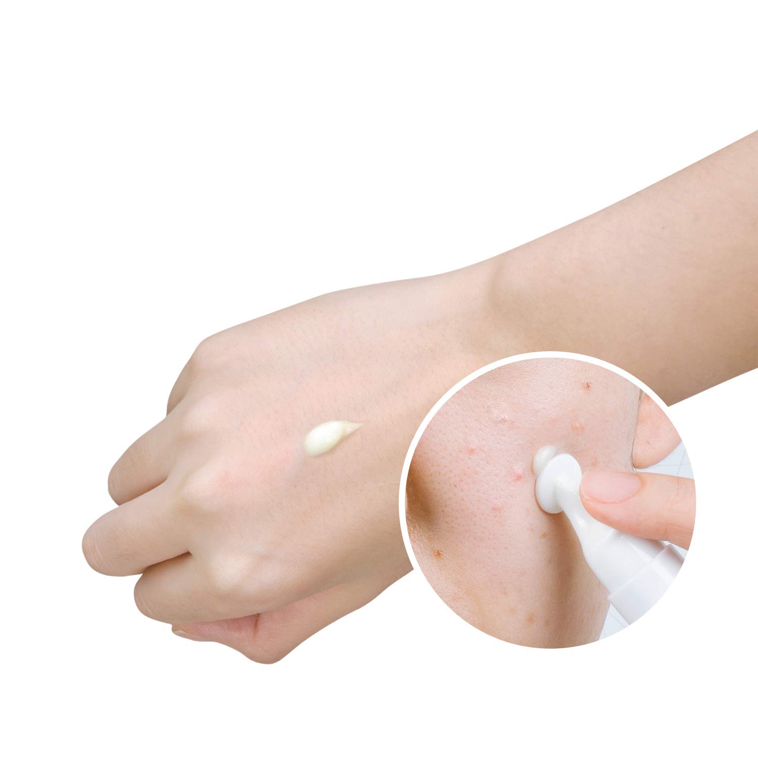 zero spot cream price