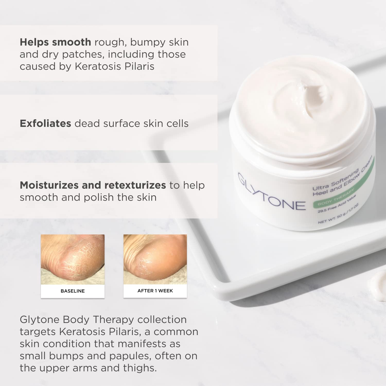 Glytone Ultra Softening Heel & Elbow Cream - 29.5 Free Acid Value Glycolic Acid - Exfoliate & Moisturize - Pedicures - Fragrance-Free - 1.7 fl. oz.