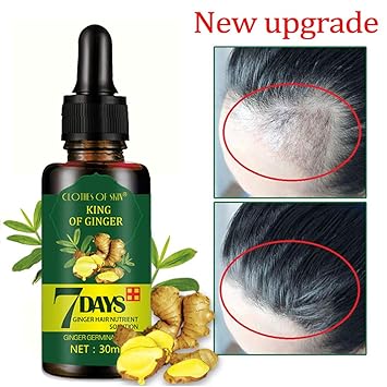 Amazon Com Wishwin Ginger Natural Wild Hair Growth Oil Hair Loss