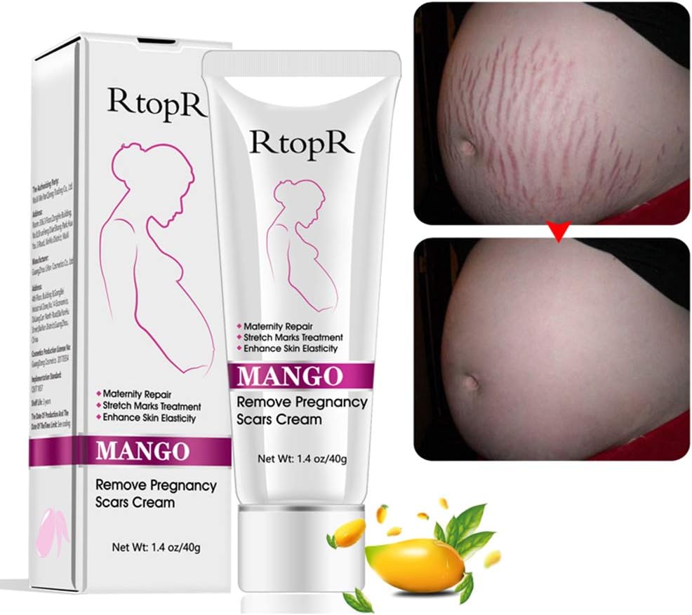 Mango Stretch Marks and Scar Cream RtopR Scar Prevention Removal Cream for Pregnancy - Best Body Moisturizer Natural Plant Nutrition Glycerin Ango Essence Formula Christmas Gift (White)