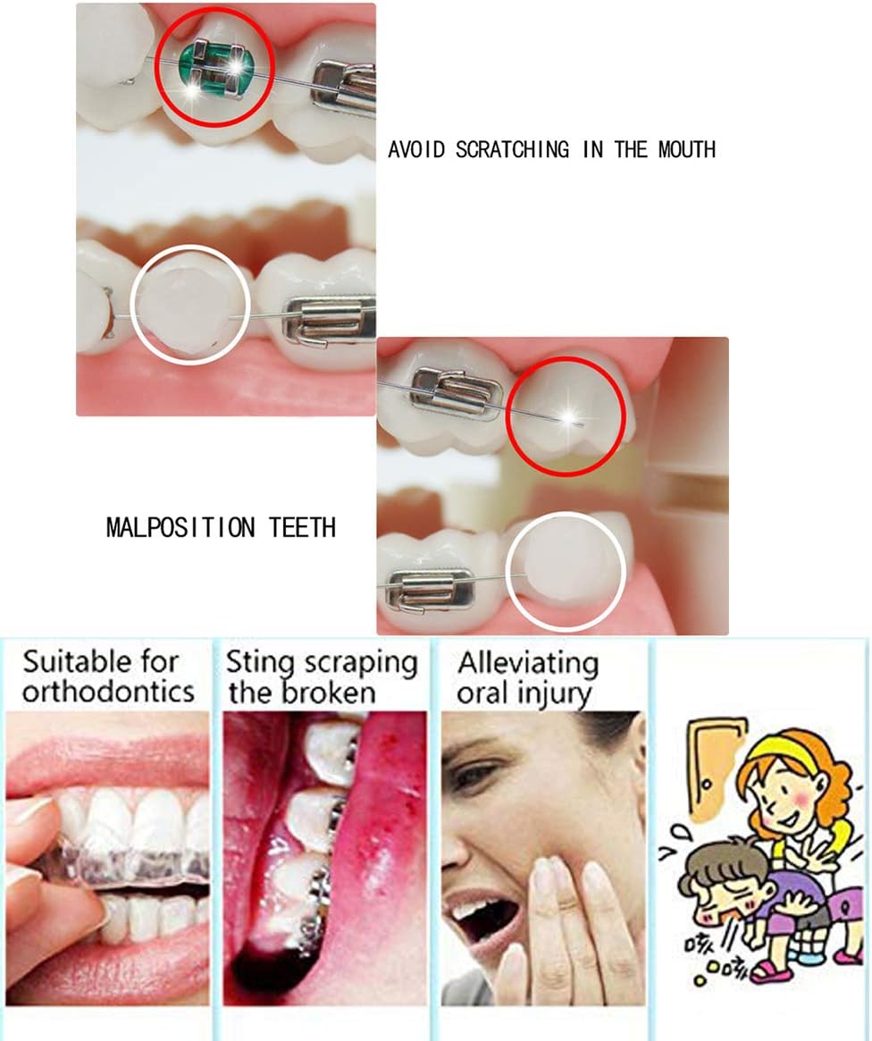 RZJZGZ Dental Wax for Braces,Dental Oral Care Orthodontics Wax for Braces with Fruit Smell for Brace Wearers Gum Protection- 6 Boxs for 300 Times - Image 4