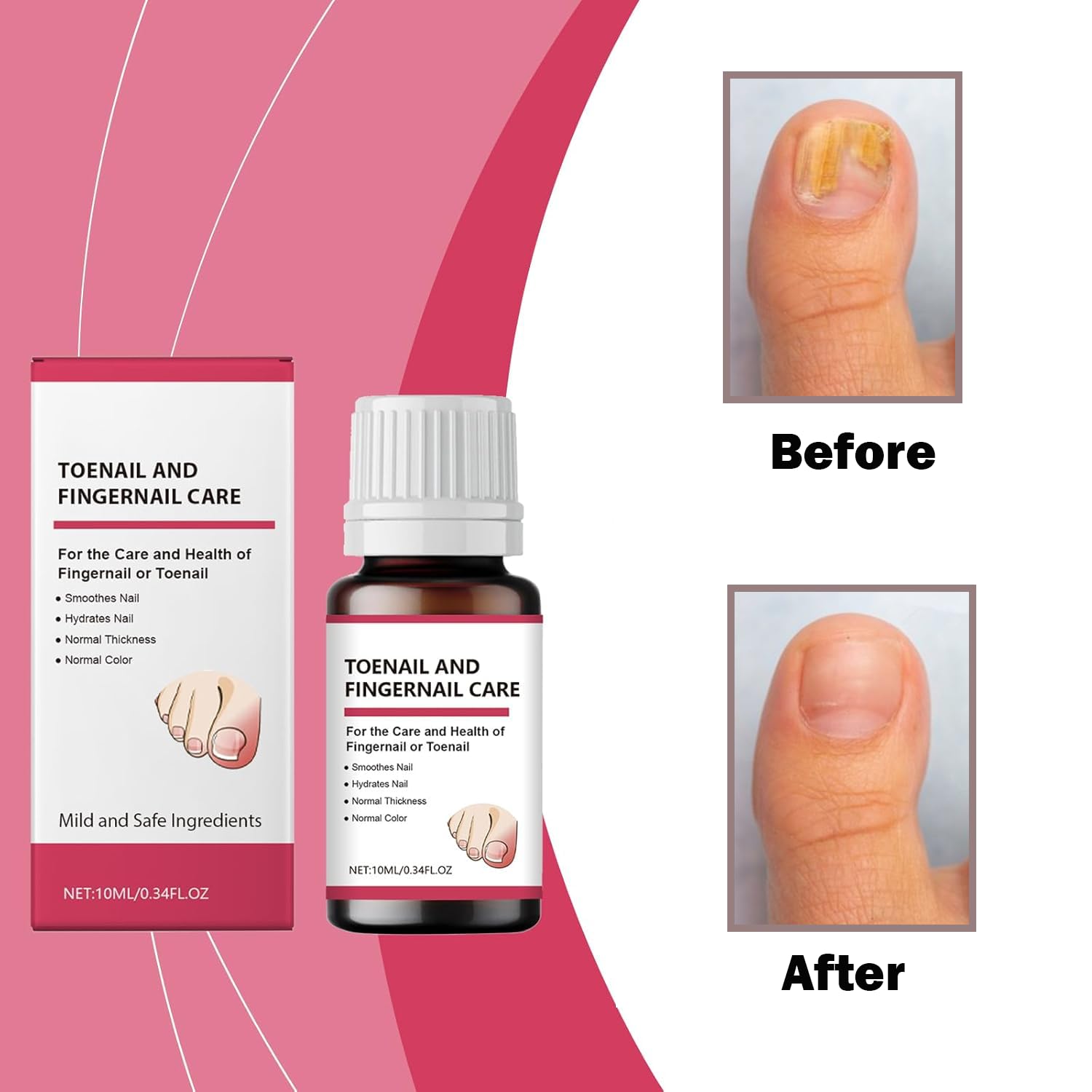 Toenail Fungus Treatment Extra Strength, Nail Fungus Treatment for Toenail,Toenail Fungus Treatments,Natural Ingredients 2 Bottles - Image 4