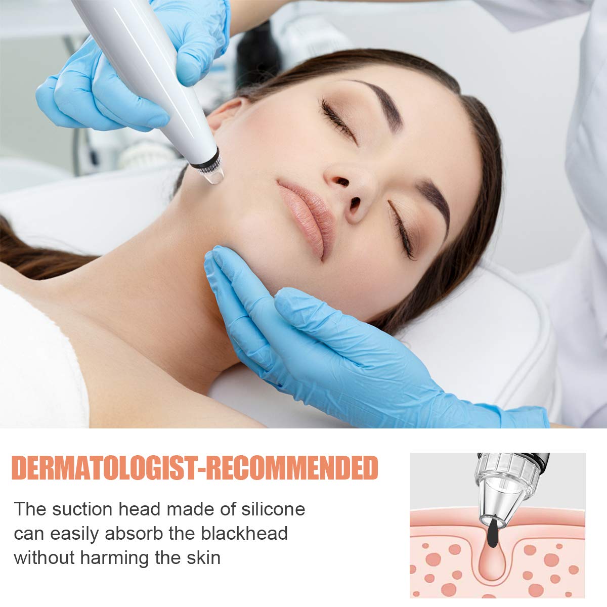 Blackhead Remover Vacuum, Electric Acne Comedone Extractor, JOMARTO Skin Pore Deep Cleansing Tool with LED, 5 Adjustable Suction Power, USB Rechargeable Pore Vacuum Cleaner for Face skin (white): Beauty