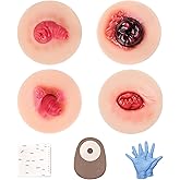 MedEduQuest Sticky Unhealthy &amp; Abnormal Stoma Simulation Models | Ostomy Care Practice Set, Stoma Care Training Kit for Nursing &amp; Medical Education