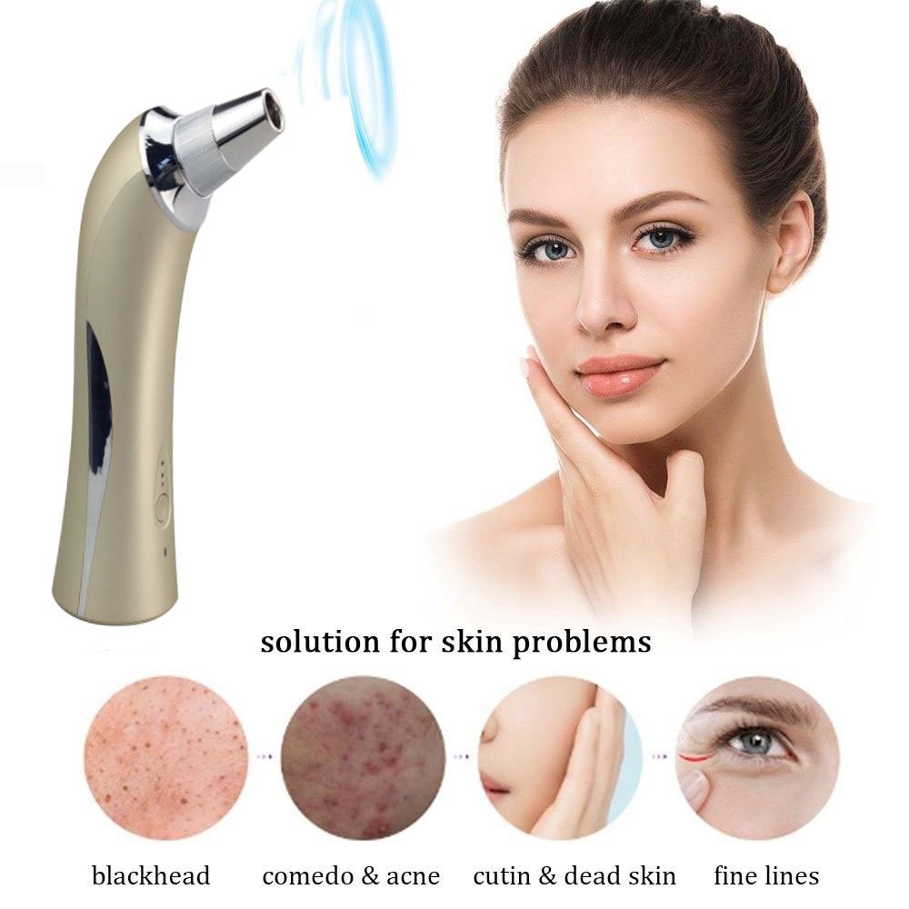 Vinmax Blackhead Suction Remover Portable Skin Peeling Pores Cleaning Blackheads Acne Remover Beauty Machine - Diamond Microdermabrasion Lift Skin Care Device