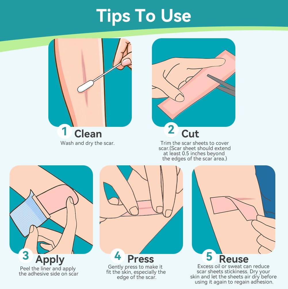 Dimora Medical Grade Silicone Scar Sheets -Ultra Soft Silicone Scar Tape (1.6”x60