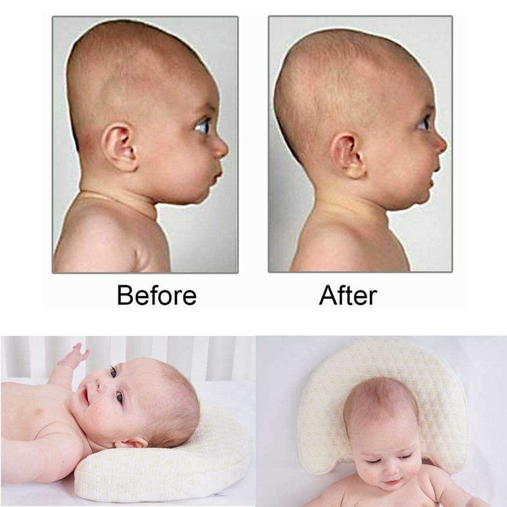 Долихоцефалическая, долихоцефалическая форма головы. Неправильная форма головы у ребенка. Нормальная форма головы у ребенка. Брахицефалическая форма головы у плода. Краниостеноз брахицефалия.