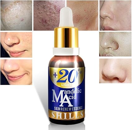 mandelic acid skin care