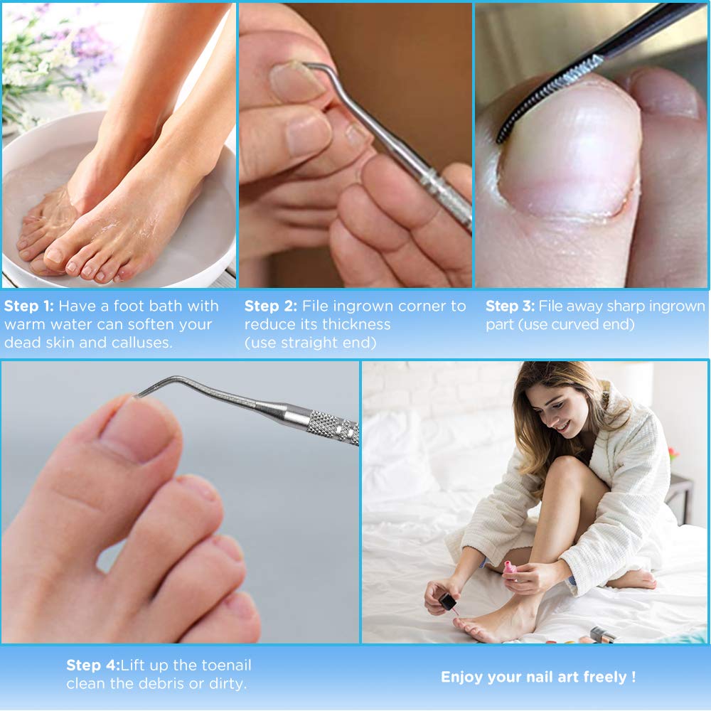 Ingrown Toenail File And Lifters,[ Upgraded ] MORGLES 5pcs Professional Surgical Safe Nail Treatment Pedicure Tool Kit Toenail Cleaner Pain Relief Under Nail Cleaner Tools: Beauty