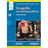Ecografia Musculoesqueletica Incluye Version Digital Exploracion De La Anatomia Y La Patologia Spanish Edition Iriarte Posse Inigo Pedret Carballido Carles Alius Matas Ramon Cerezal Pesquera Luis 9788491104674 Amazon Com Books