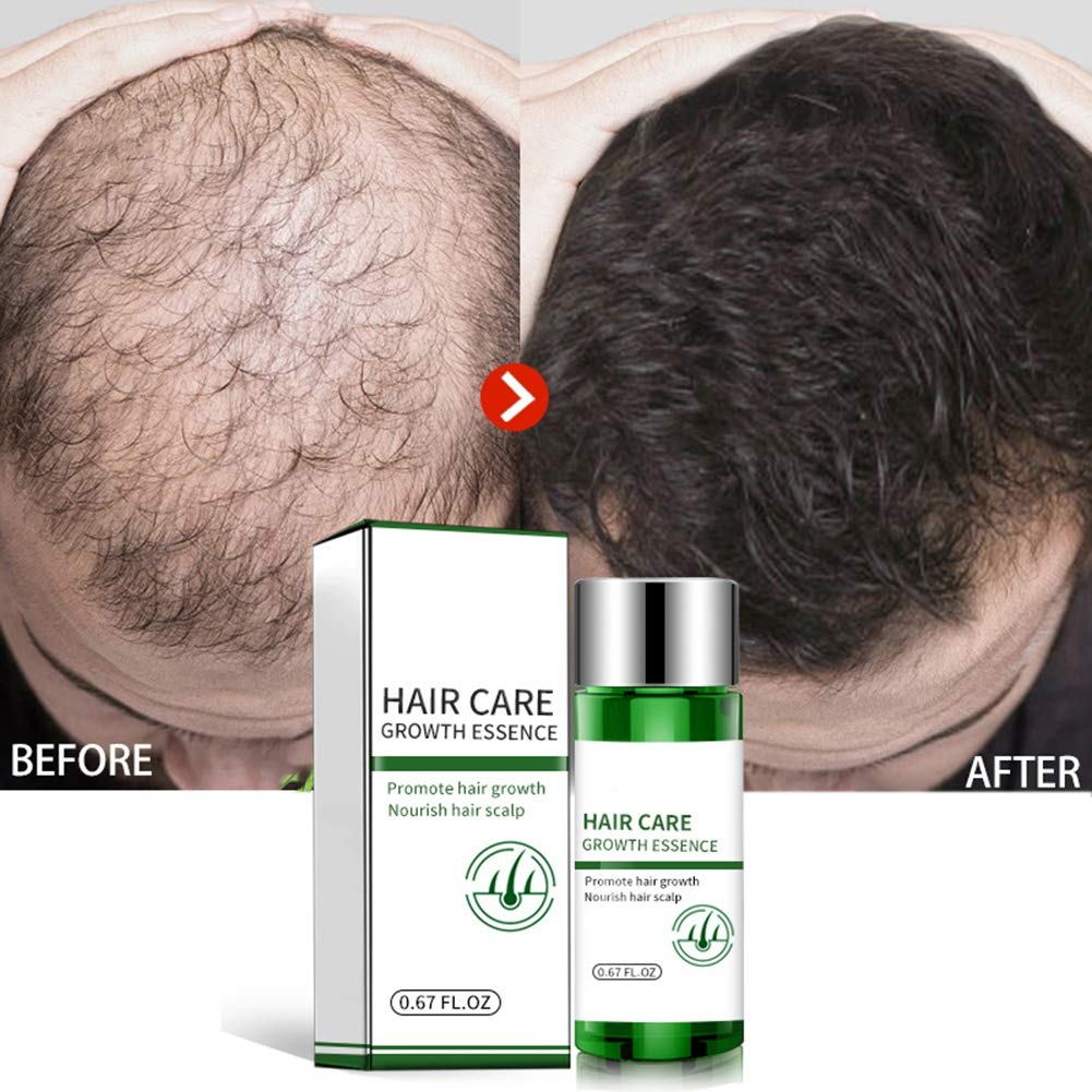 Amazon Com Pretty Comy Hair Growth Essential Oil Hair Care