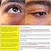 TheMagicLift Instantly Ageless Face Lift Serum - For 3-to-8 HOURS Get Rid of Bags Under Eyes, Dark Circles, Wrinkles, Fine Lines, Puffiness. Dinner Parties Magic. 5 Vials (10ml total), with Argireline
