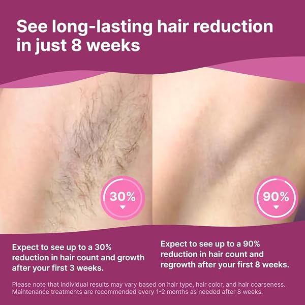 HAPPY CURVES BEAM IPL LASER HAIR REMOVAL DEVICE – AT-HOME PERMANENT BODY HAIR REMOVAL FOR WOMEN, SKIN-SENSING, LCD DISPLAY, INCLUDES UV SUNGLASSES & RAZOR