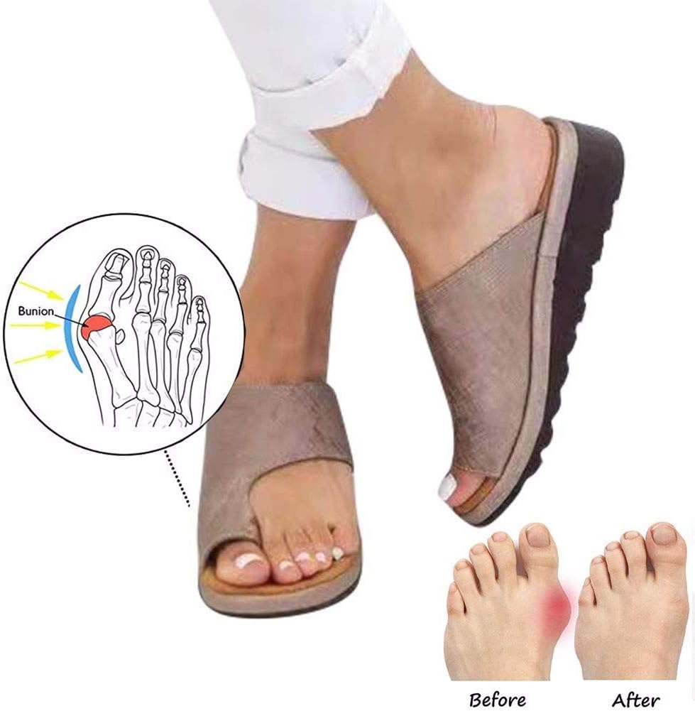 comfy toe bunion corrector sandals