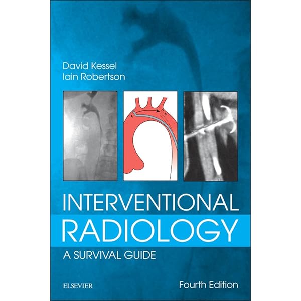 Amazon.com: Vascular & Interventional Radiography A Comprehensive