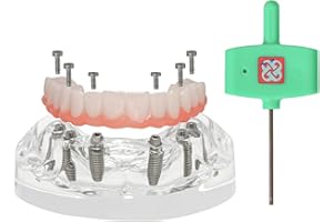 Dental Implant Model, Implant All-On-6 Overdenture Treatment Typodont Model, Upper Jaw with Transparent Base, 6 Implants