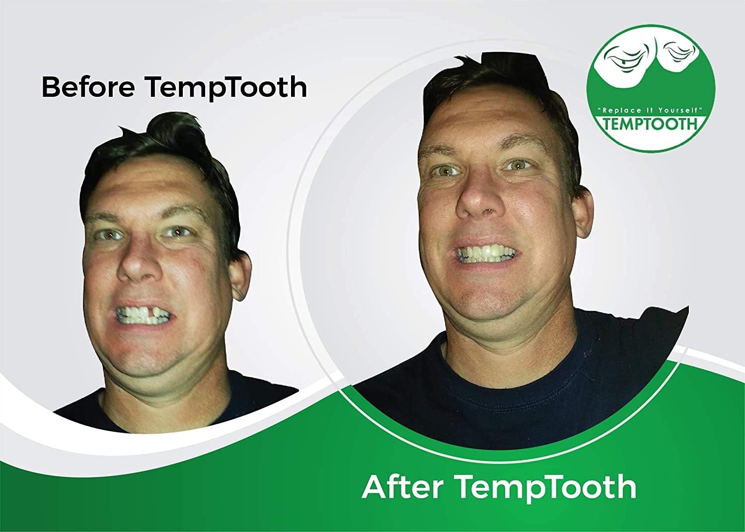Temptooth #1 Seller Trusted Patented Temporary Tooth Replacement Product: Health & Personal Care
