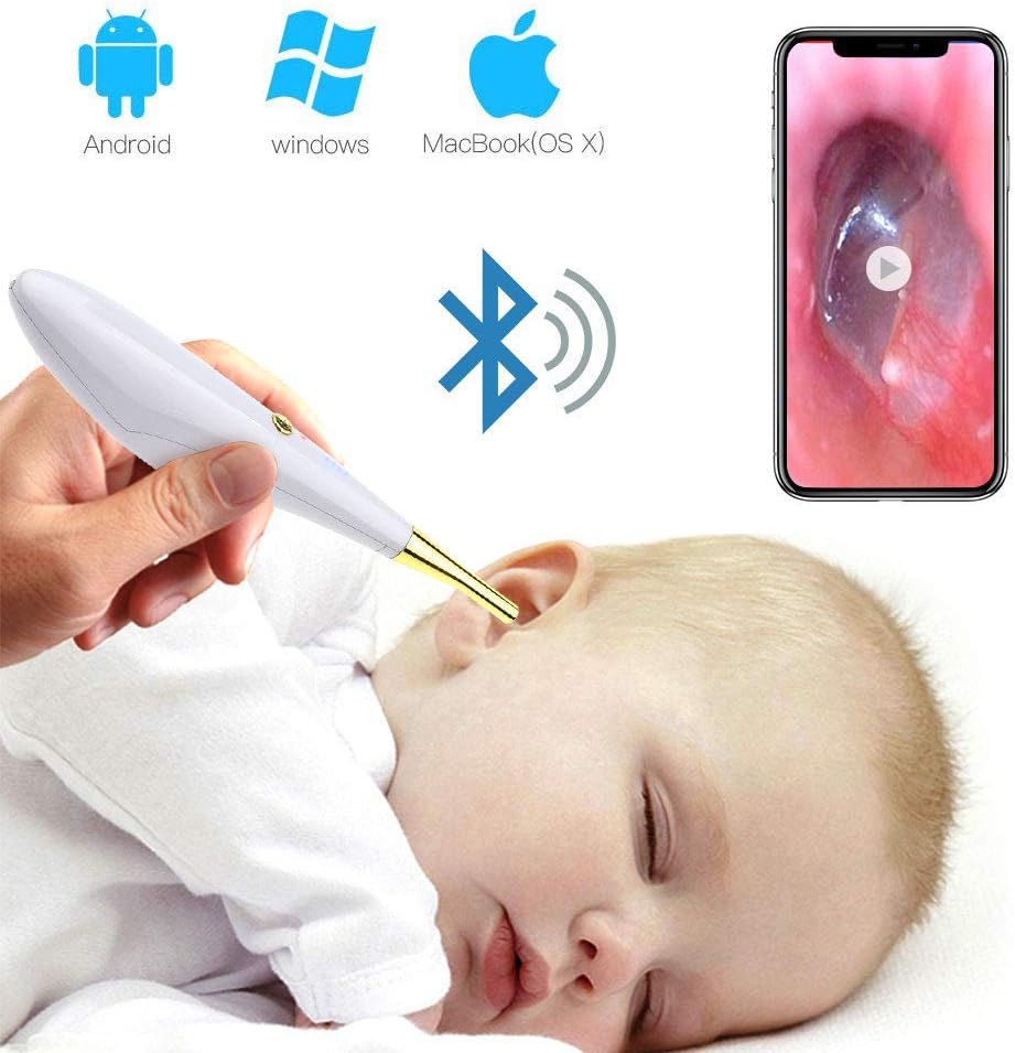 Otoscope numérique, caméra de contrôle de la cire Evaky HD sans fil