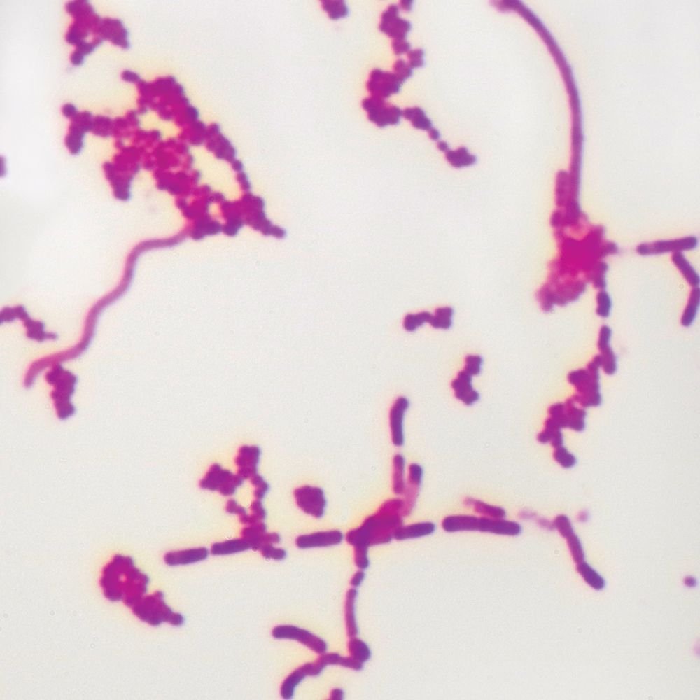 Mixed Smear of Bacteria Types Slide Carbol-Fuchsin w.m ...