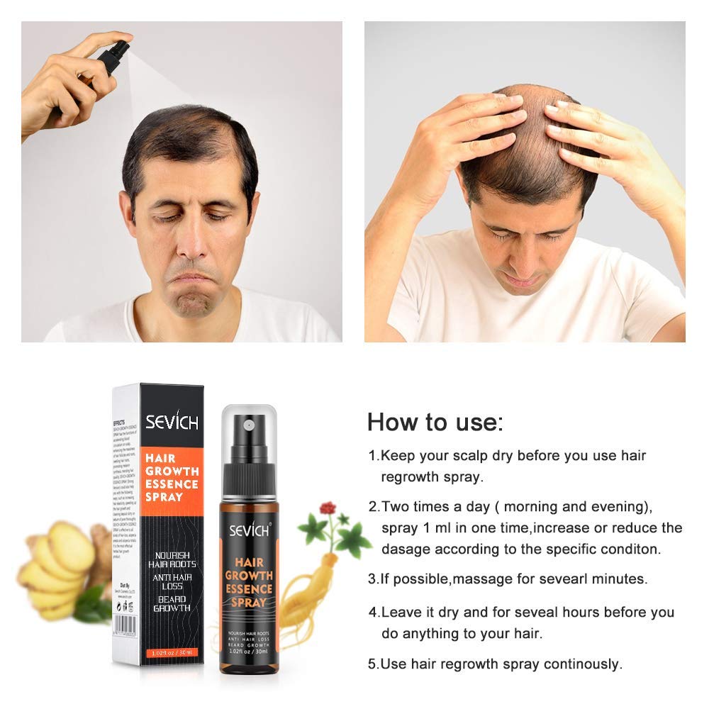 Hair Grow Spray, Anti Hair Loss, Thinning, Balding, Natural Ingredients Hair Regrowth Treatment for Stronger, Thicker, Longer Hair Grow, Repair Hair Follicles, All Hair Types, Men and Women : Beauty