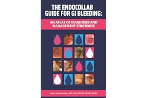 The EndoCollab Guide for GI Bleeding: An Atlas of Diagnoses and Management Strategies