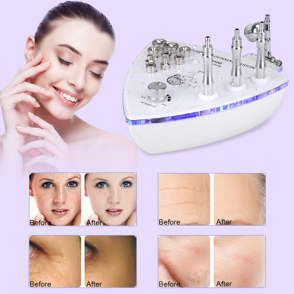 Diamond Microdermabrasion Machine with Spray Gun, MYSWEETY 65-70cmHg Suction Power Professional Dermabrasion Machine & Water Spray Exfoliation Facial Beauty Machine Skin Care Equipment for Home Use: Beauty