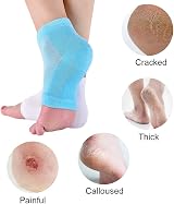 CGBOOM Moisturizing Gel Heel Socks Toe Open for Dry Cracked Skin Pain Relief 2 view 2
