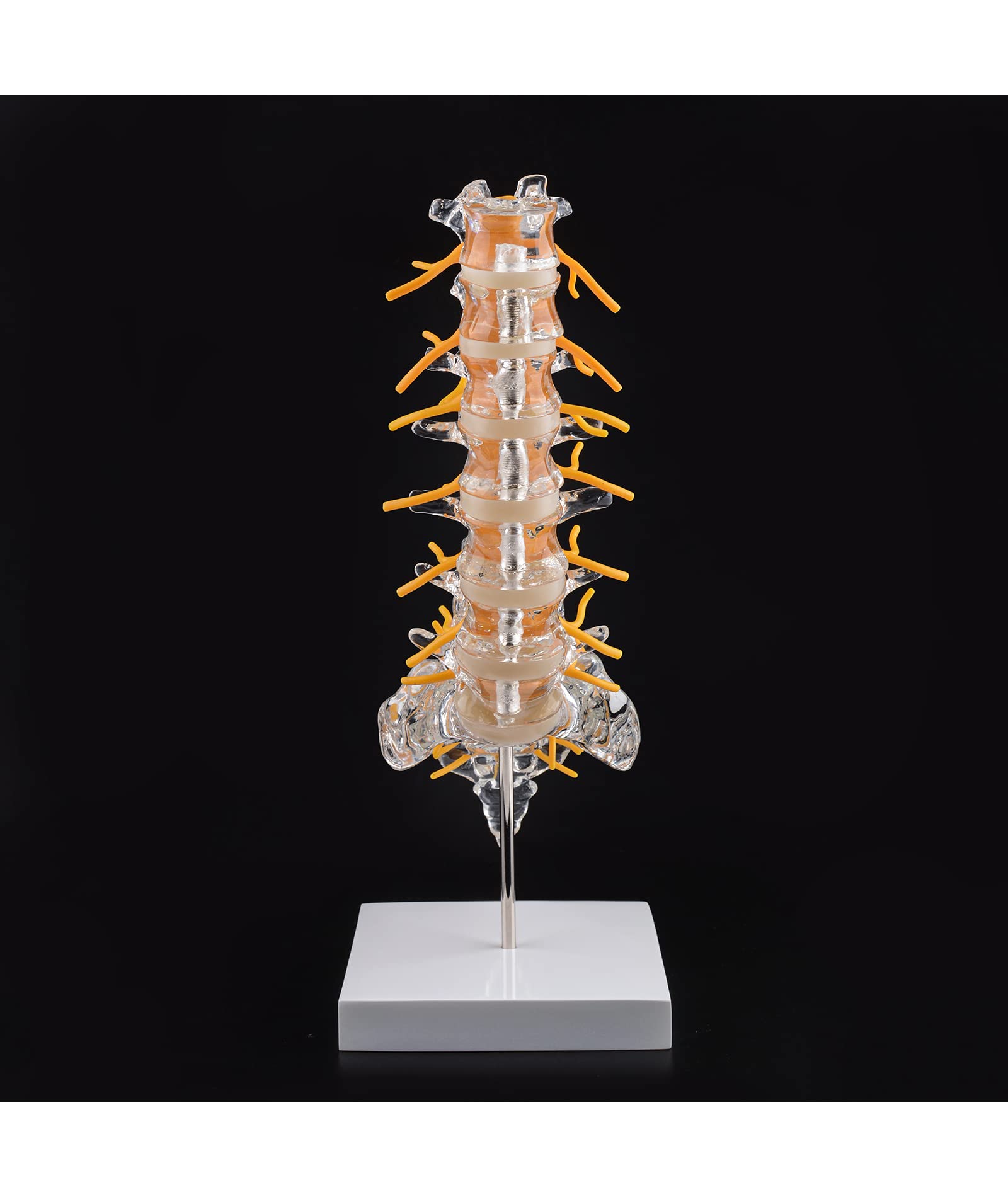 Mua Ultrassist Human Transparent Lumbar Spine Anatomy Model - Model ...