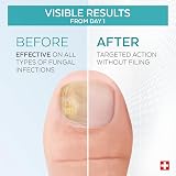 Poderm Purifying Nail Fungus Serum 2 Pack PODERM view 3