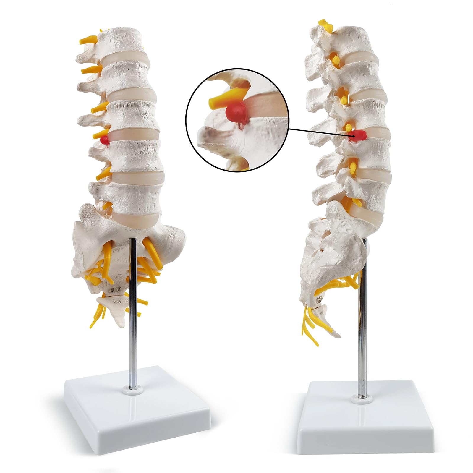 Mua 2025 New Life Size Lumbar Spine Model -Human Lumbar Vertebrae ...