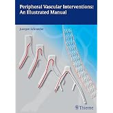 Peripheral Vascular Interventions: An Illustrated Manual