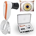 JOSKAA Iriscope Iridology Camera, 5.0 Mp USB Iris Analyzer Iridology Camera, 5.0m Pixels USB Left/Right Lamp Analyzer/Analysis Iridology Camera with Pro Iris Software