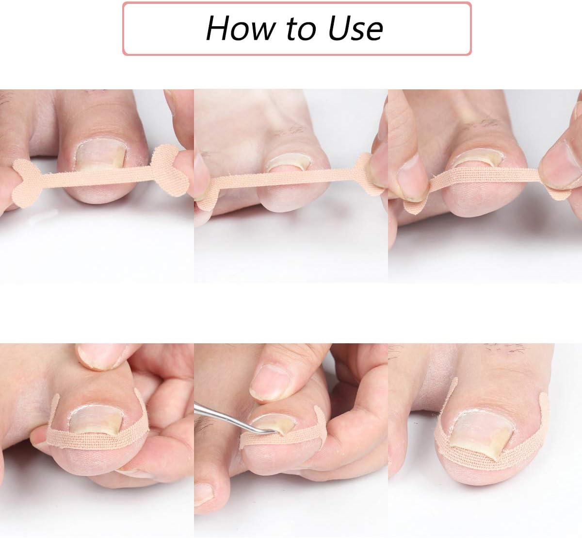 EBANKU 5 Sheets/20 Pcs Ingrown Toenail Corrector Stickers, Toe Nail Treatment Elastic Patch Sticker Corrector Pedicure Tools Fingernail Toe Nail Care Protects Toe Nail: Arts, Crafts & Sewing