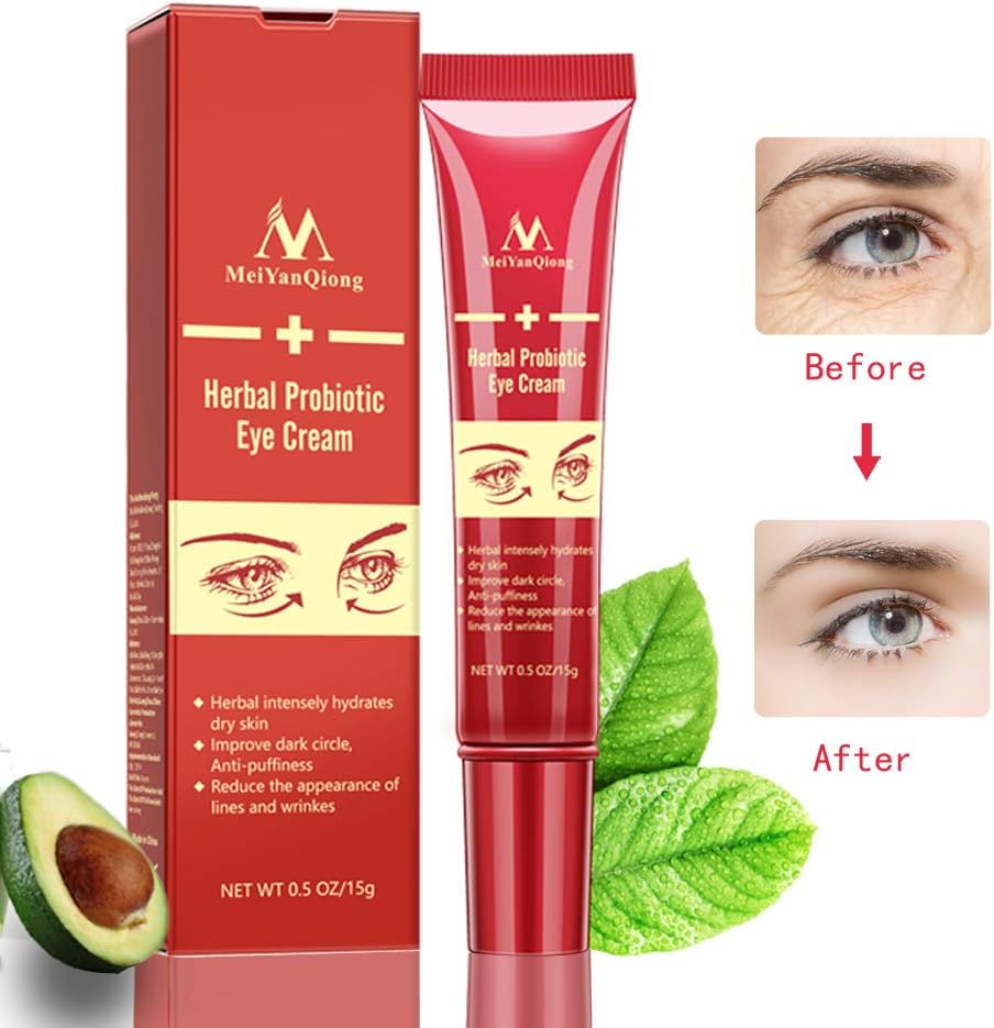 Amazon Co Jp アイクリーム くま しわ たるみ 対策 アイケア 潤い ハリ 全方位 目元ケア 天然美容エキス 男女兼用 15g ビューティー