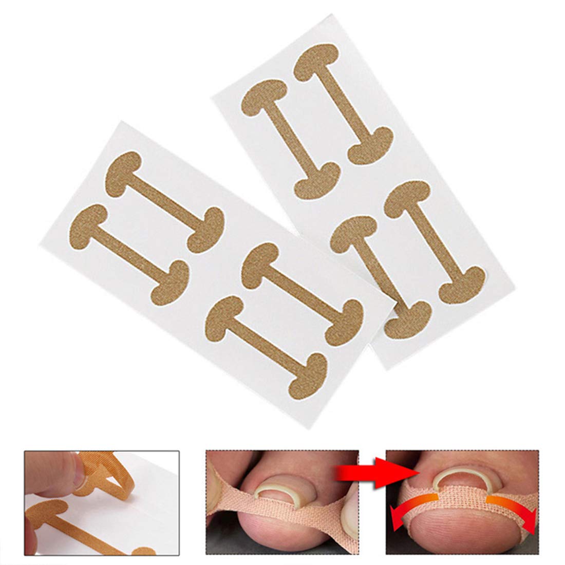 20 Pcs Ingrown Toenail Corrector Stickers, Toe Nail Treatment Elastic Patch Sticker Corrector Pedicure Tools Fingernail Toe Nail Care Protects Toe Nail: Beauty