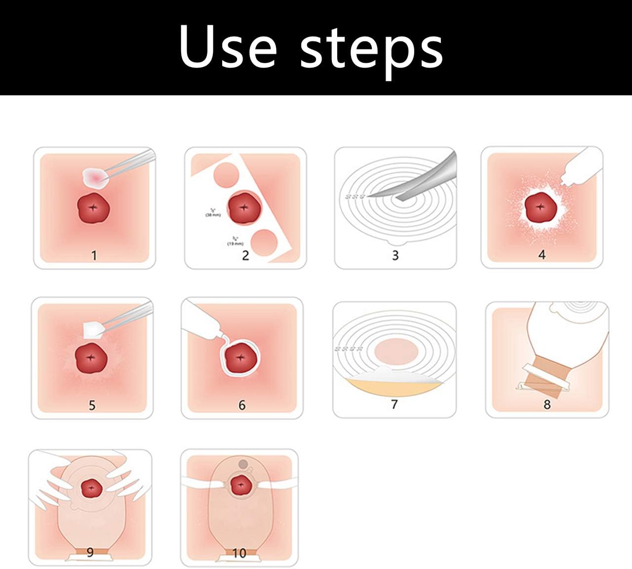 Eyourlife 20 Pack Ostomy Colostomy Bags, Premium Medicals Drainable Pouch Colostomy Bag One Piece System, Cut to Fit 20-65MM: Health & Personal Care