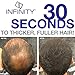 Infinity Hair Fibers for Thinning Hair (LIGHT BROWN) For Women & Men - 100% Undetectable Fibers - 15g Bottle - Completely Conceals Hair Loss in 15 Seconds