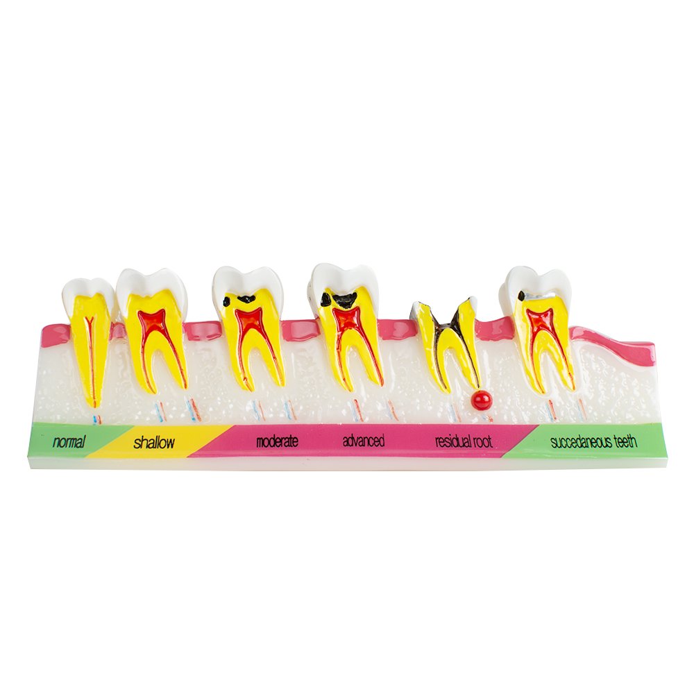 Pevor Dental Teeth Model Periodontal Disease Assort Tooth Typodont Study Teaching Model