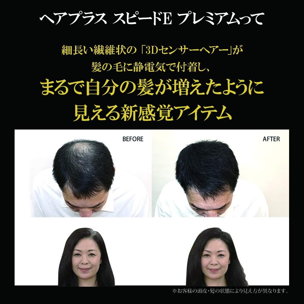 Amazon アデランス ヘアパウダー ヘアプラス スピードe プレミアム パウダー ブラック 30g ボリューム感アップ 増毛 白髪 薄毛 分け目 つむじに 白髪 かくし アデランス 増毛 ボリュームアップスプレー 通販