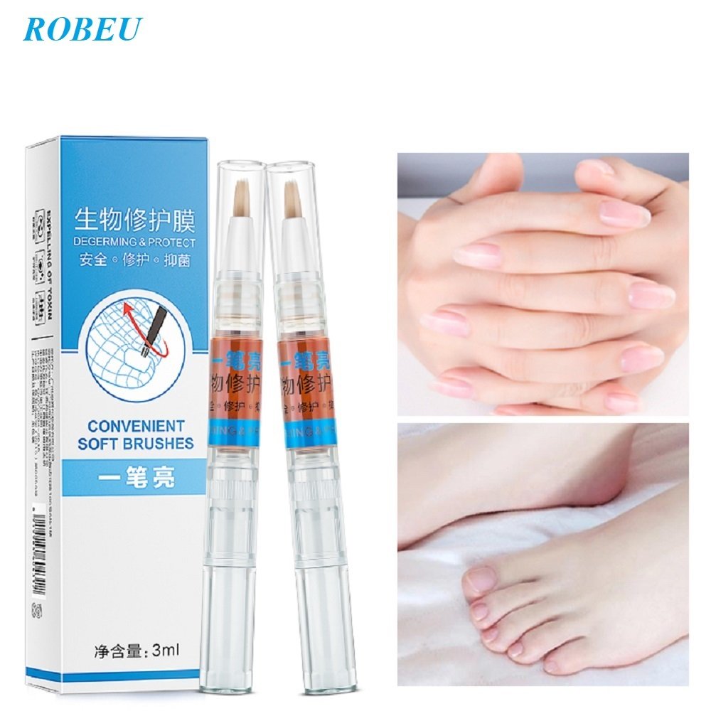 Repair Nail Hole Car Tire, Amazon Com 1pcs Fungal Nail Nail Treatment Pen Infection Nail Bright Pencil Fungal Treatment Anti Fungus Biological Repair 3ml Restores Healthy Nails, Repair Nail Hole Car Tire