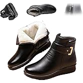 XYLAWAVE Women's Metal Buckle Genuine Leather Wool Orthopedic Boots,Winter Warm Slip On Fur Lined Snow Boots with Side Zipper