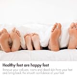 Revitale Natural Volcanic Lava Pumice Foot Stone 2 Pack - Pedicure Dead Skin view 4